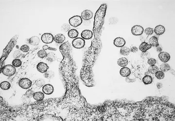 Australisch lab mist gevaarlijke virussen door ...