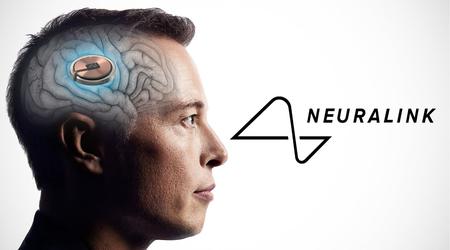 Geen enkele aap stierf - Musk claimt veiligheid van Neuralink hersenimplantaten