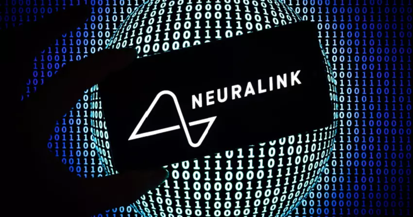Onregelmatigheden in Neuralink-tests gevonden in de VS 