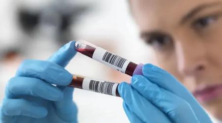 Chinese wetenschappers creëren AI-bloedtest die ziekten 15 jaar voordat de symptomen verschijnen kan diagnosticeren