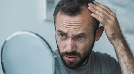 Wetenschappers hebben een onverwachte eigenschap van DNA-suiker ontdekt die haaruitval bij mannen en vrouwen zou kunnen oplossen