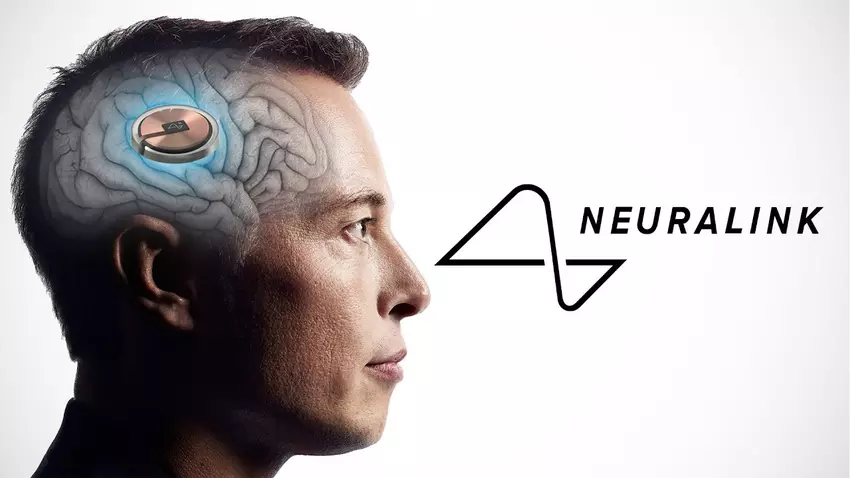 Geen enkele aap stierf - Musk claimt veiligheid van Neuralink hersenimplantaten