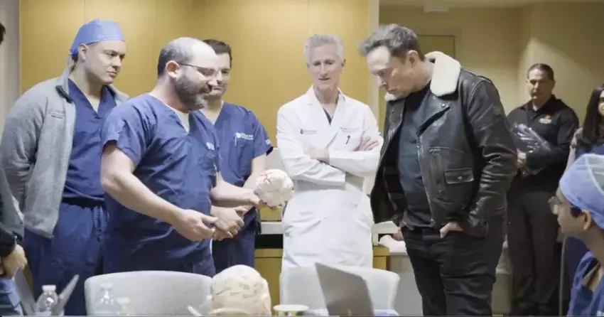 Neuralink krijgt goedkeuring voor implantatie van tweede hersenimplantaat