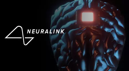 Uitbreiding van het Neuralink-programma: vrijwilligers van over de hele wereld kunnen zich nu aanmelden voor implantatie van de innovatieve neurochip