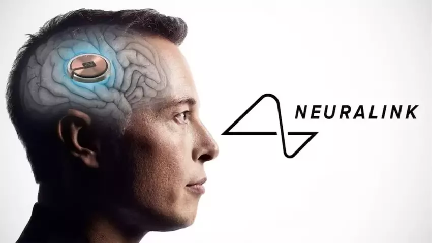 Neuralink ontwikkelt Blindsight-chip waarmee blinden kunnen zien