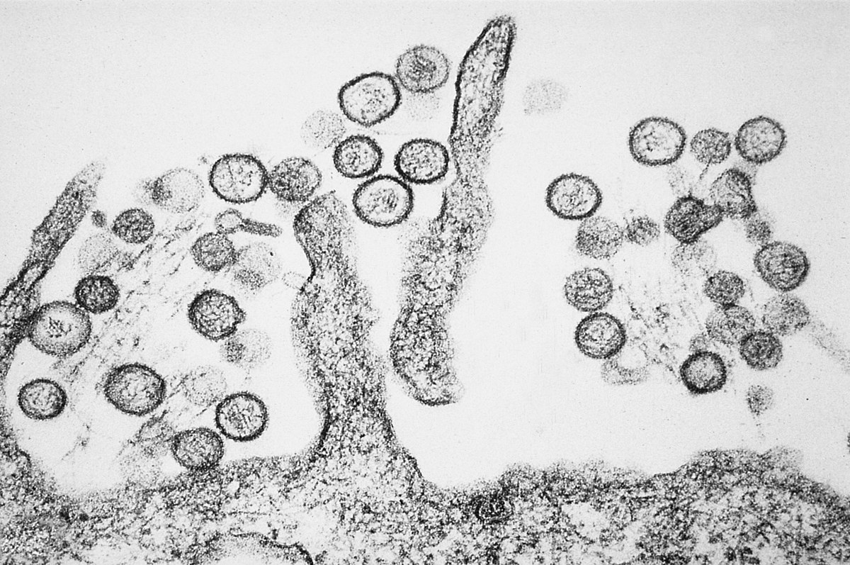 Een microscopische blik op hantavirus: nieuwe beelden Een kijkje binnenin: een unieke microfoto van hantavirus